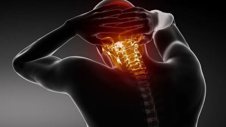 osteochondrosis nke spine cervical